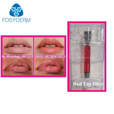 Relleno de labios rojos con vitamina B12 Acido hialurónico inyectable Relleno de labios de belleza agrandamiento 1 ml
