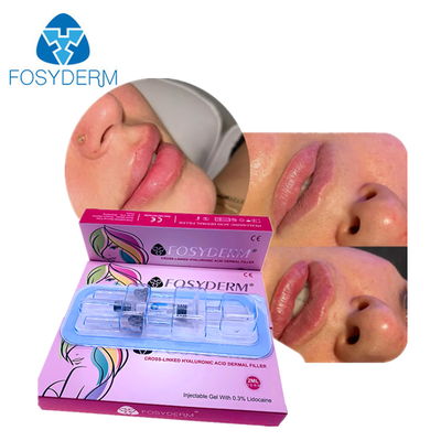 Rejuvenecimiento facial HA Relleno dérmico para la cara Barbilla mejilla labios Cuerpo Bestia Gongo