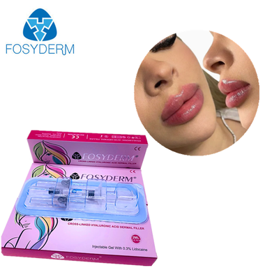 Relleno Fosyderm Ácido Hialurónico Relleno Dérmico Inyección para labios 2ml