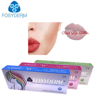 1ml 2ml Hyaluronic Acid Dermal Filler Anti‑Wrinkle Lip Enhancement 24mg