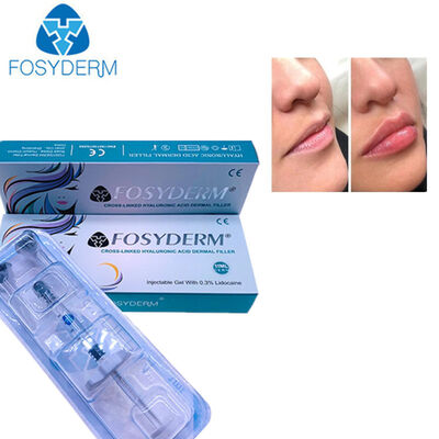 Hyaluronic Acid Dermal Filler Face Lifting 24mg 1ml Derm