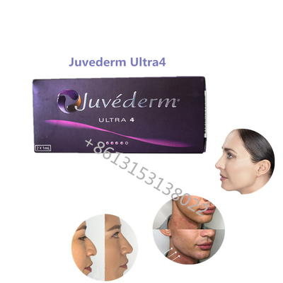 Llenadores cutáneos de Juvederm ha del llenador de Juvederm Ultra4 Allergan de la plenitud del labio para los labios