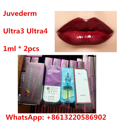 Llenador cutáneo de la ha del labio de Juvederm con la lidocaína Ultra3 Ultra4