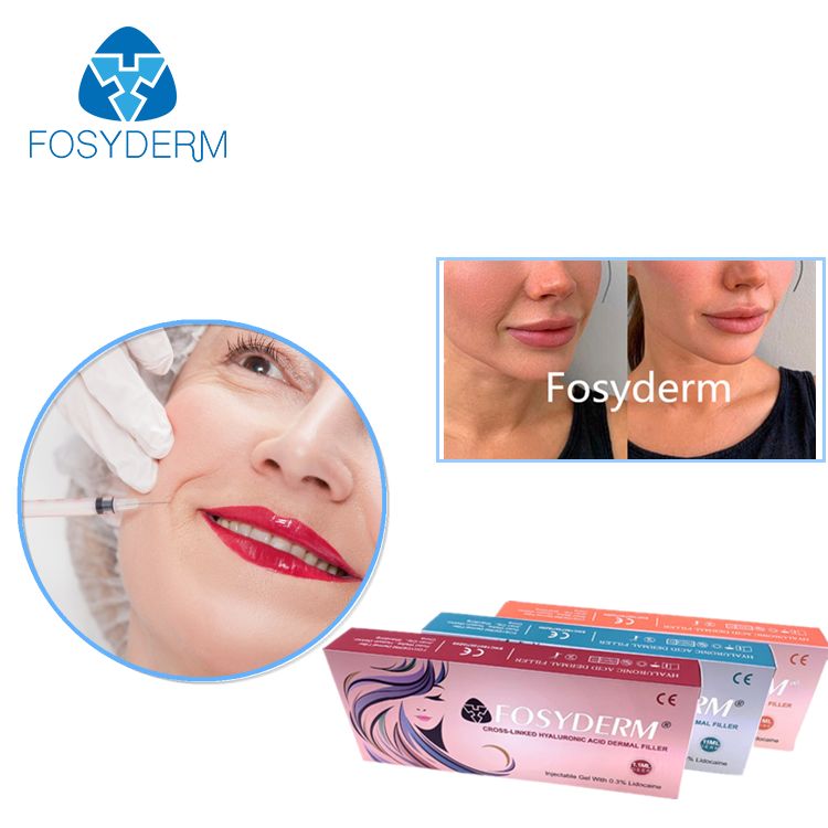 5ml Hyaluronic Acid Dermal Filler Fine Type Featuring 2 Years Shelf Life Ideal for Skin Hydration and Facial Volume Restoration Treatments