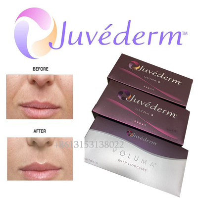 Inyección duradera ácida hialurónica del llenador facial Ultra3 Ultra4 Voluma de Juvederm