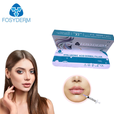La cruz ácida hialurónica del CE de Fosyderm ligó el llenador cutáneo para los labios encima de 24mg/Ml