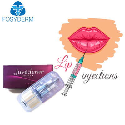 Llenador cutáneo ácido hialurónico ultra 3 de Juvederm para los labios de la cara