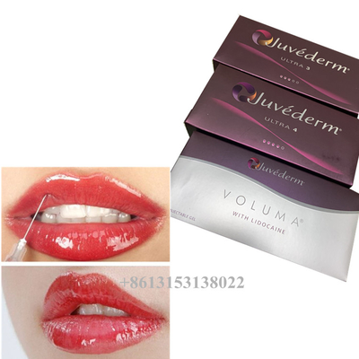 Juvederm Voluma Acido hialurónico Gel de relleno dérmico 24 mg/ ml Rellenes dérmicos