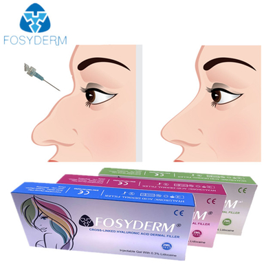Inyección cutánea ácida hialurónica 1ml 2ml del llenador de la nariz para usar femenino