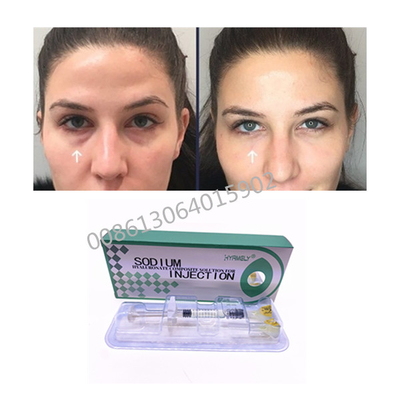 Quite la solución compuesta de Hyaluronate del sodio oscuro de los círculos 1ml