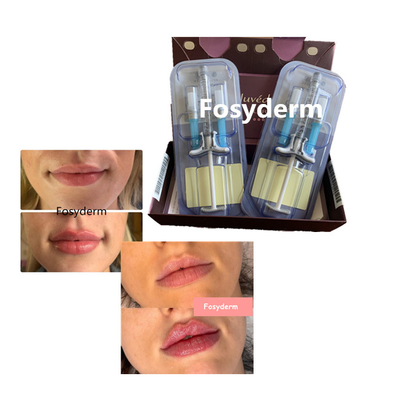 La cruz ácida hialurónica del llenador de los labios del volbella de Juvederm ligó 24mg