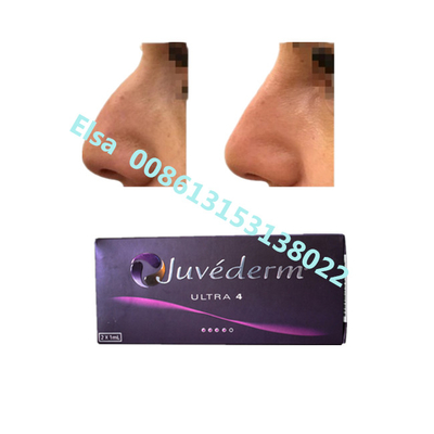Juvederm Sodium Ultra4 Voluma Relleno dérmico para el aumento de la barbilla labial
