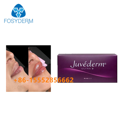 Inyección ácida hialurónica cutánea de Juvederm 2ml del llenador del aumento del labio