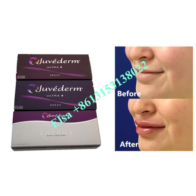 Inyección de relleno dérmico Fosyderm de ácido hialurónico Voluma 24 mg/ml