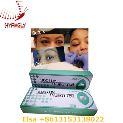 Relleno dérmico anti ojeras de gel de hialuronato de sodio de 1 ml para ojos