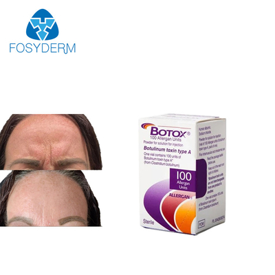 Antiarrugas  De Allergan Inyectable 100 Unidades