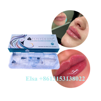 Ce ácido hialurónico 1ml antienvejecedor 2ml 5ml del llenador del labio de Juvederm de la inyección del gel
