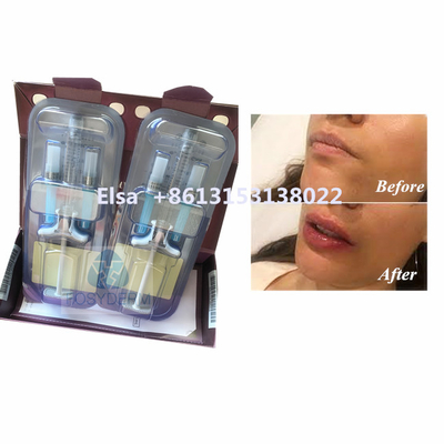 Producto de belleza Juvederm Voluma Ácido hialurónico Relleno facial HA inyección