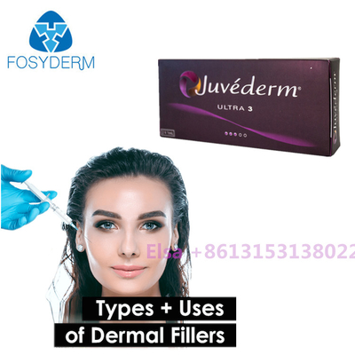 Jeringuilla cutánea de Juvederm de los llenadores de Voluma/ultra de Juvederm con Lido