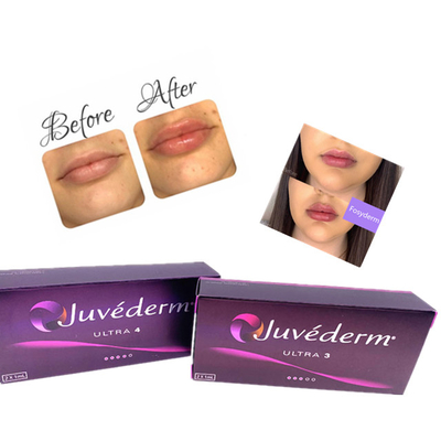 Ce cutáneo ácido hialurónico 2ml antienvejecedor del llenador del labio de Juvederm de la inyección del gel