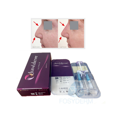 El labio de la cara reticuló el gel ácido hialurónico cutáneo de Juvederm Ultra3 del llenador