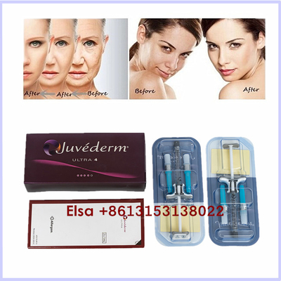 Inyección cutánea ácida hialurónica estética del gel del llenador de Juvederm Ultra3 Ultra4 Voluma de los productos