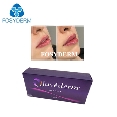 El ácido hialurónico coreano está vinculado a la piel con el relleno de la piel Juvederm Lip Filler Injections