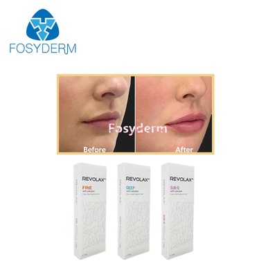 1.1 ml Relleno de labios dérmicos Revolax Sub-Q fino y profundo para la inyección de ácido hialurónico antiarrugas
