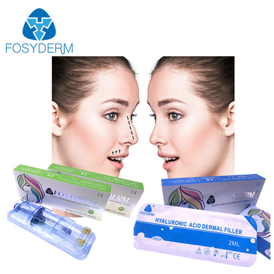 Fosyderm 2 ml Hyaluronic Acid Dermal Filler para las arrugas faciales labios mentón mejillas