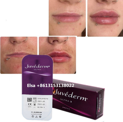 Cosméticos Cuidado de la piel Inyecciones Plumper labial Juvederm Inyección de relleno para la nariz y el mentón