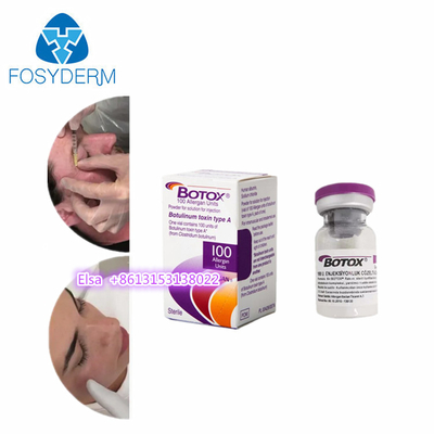 Allergan  Toxina Botulínica 100 UI inyección de  Dysport 500 antiarrugas