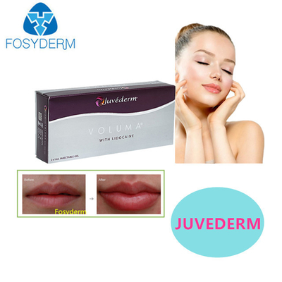 Juvederm ácido hialurónico relleno cutáneo labios sexys 24mg para el rostros