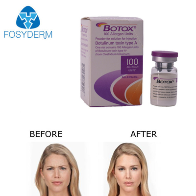 Inyección de Botox Allergan 100 Unidades para la Eliminación de Arrugas