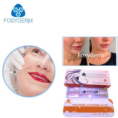 2 ml de relleno de labios para inyección de ácido hialurónico relleno cutáneo inyectable para gel de agrandamiento de labios