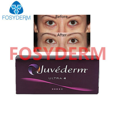 Juvederm Hyaluronic Acid Dermal Filler para el levantamiento de labios y cara 24 mg