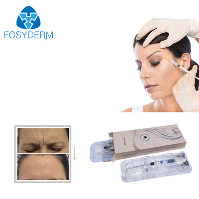 Llenador reticulado pre llenado de Fosyderm de la plenitud del labio