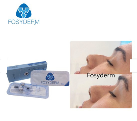 La cruz de Fosyderm unió la línea profunda llenador cutáneo del llenador 2ml para la nariz