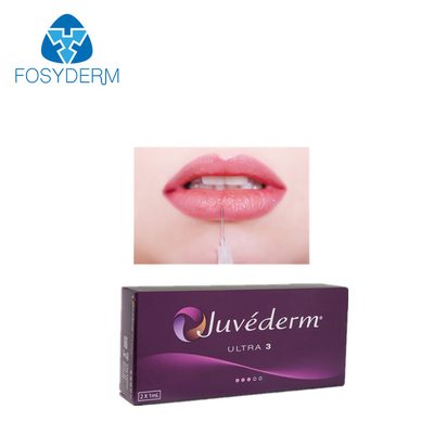 Llenador cutáneo ácido hialurónico ultra 3 2*1ml de Juvederm del labio