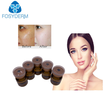 suero de 20mg/ml 5ml Mesotherapy que blanquea la solución meso