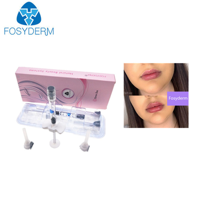 inyección ácida hialurónica del labio 1ml de los llenadores cutáneos de 0.28m m ha