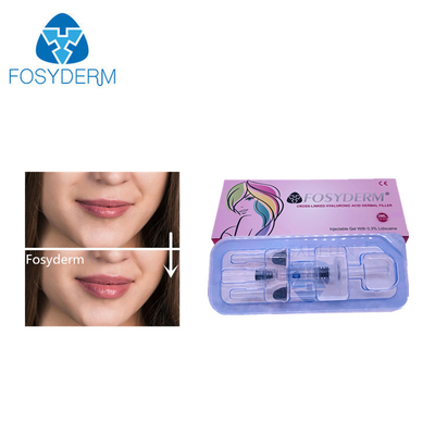 2 ml de relleno de ácido hialurónico Relleno dérmico para la cara, nariz, aumento de tamaño del labio 24 mg/ml