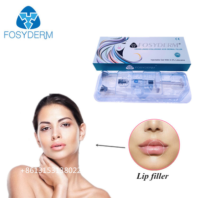 Fosyderm 1 ml de ácido hialurónico inyecciones de relleno dérmico para aumentar el tamaño de los labios