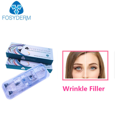 Inyecciones faciales de 1,1 ml para el llenador cutáneo de la ha de las arrugas