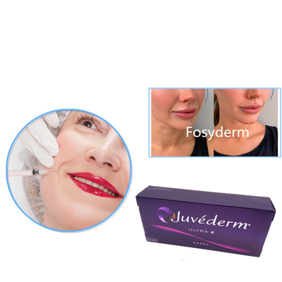 Juvederm ultra 3 ultra 4 inyección cutánea del gel del llenador de Voluma has