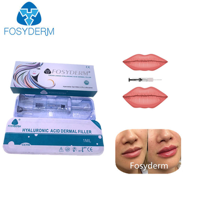 la cruz 1ml ligó el llenador cutáneo ácido hialurónico para los labios sospecha a Chin
