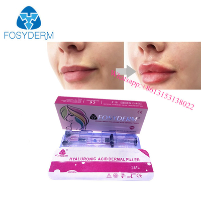 Inyección cutánea ácida hialurónica del gel del llenador de la ampliación del labio del OEM