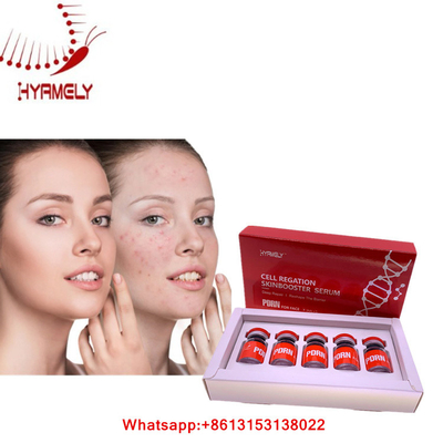 Suero de PDRN para la inyección facial Mesotherapy de Hyamely de la regeneración de la piel