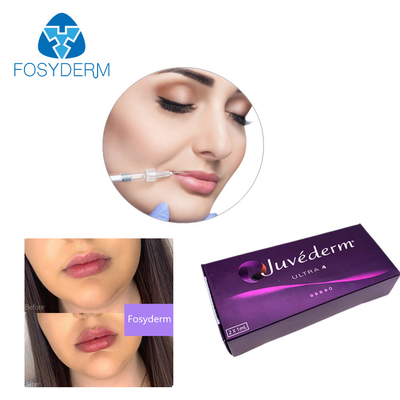 Llenador cutáneo ácido hialurónico 24mg/Ml del labio de Juvederm del gel del llenador de Ultra3 Ultra4 Voluma