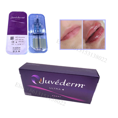 Juvederm Ultra4 Relleno dérmico Relleno labial Elevación facial Ha Gel inyectable