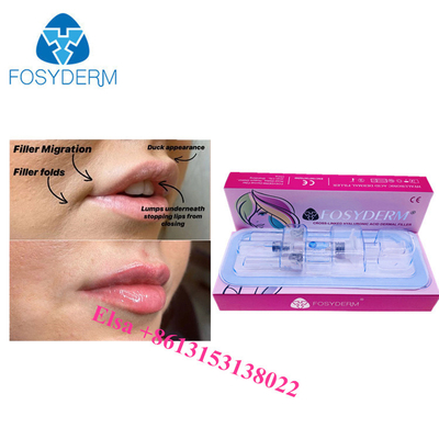 Ácido hialurónico para inyecciones 1 ml 2 ml 5 ml